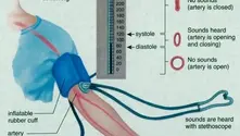 Curcumin and its Role in Lowering Blood Pressure
