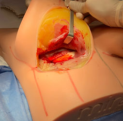 Breast Trainer Surgery Simulator (2).jpg