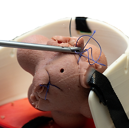 Myomectomy Model.png