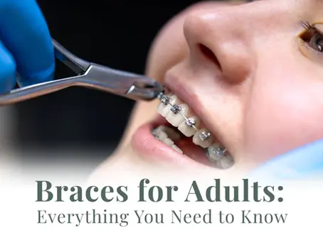Braces for Adults: Everything You Need to Know