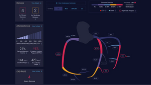 Atherosclerosis: See it early, Stop it early