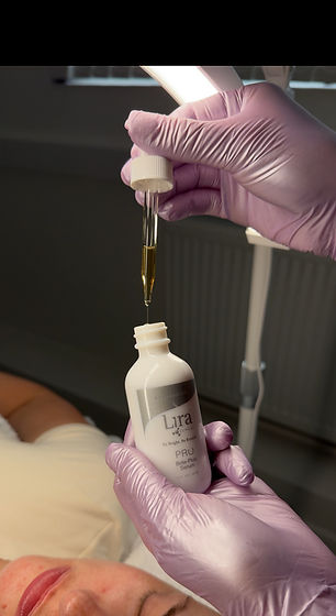 lira peel_edited.jpg