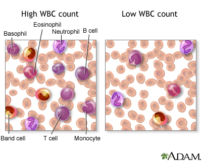 Determining Bacterial or Viral Infection By A Horse's White Blood Cell Count