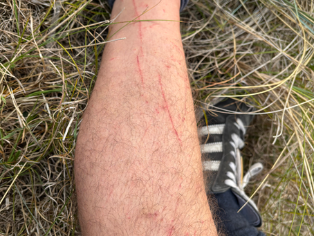 Battle Scars!