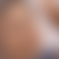 Pós-Carnaval: saiba como cuidar da pele madura após os dias de folia