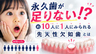 永久歯が足りない