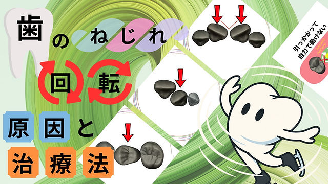 MFT（口腔筋機能訓練）