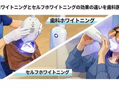歯科のホワイトニングとセルフホワイトニング