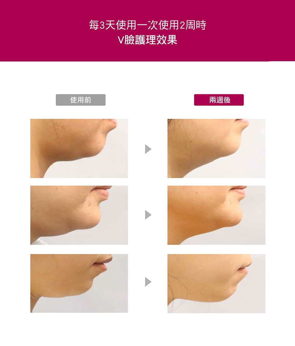 縮圖：V型瘦瘦臉拉提精華30ml　　　　　　　　8809430536453