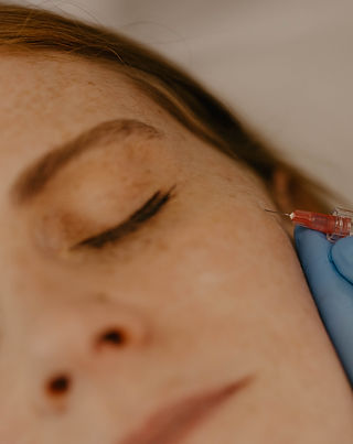 By Jess Aesthetics - Treatment - PROFHILO.jpeg