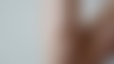 粉瘤 痘痘 囊腫 切除 酸臭 切除 手術 蓮華皮膚科 台中 台灣