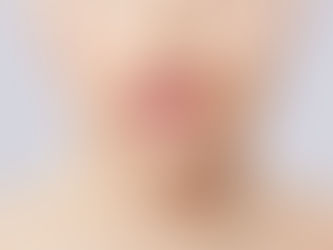 Hassas Ciltler İçin Bakım Rehberi