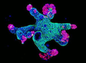 Cancer organoid: a new hero for cancer research
