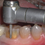 Thumbnail: Single dental crown