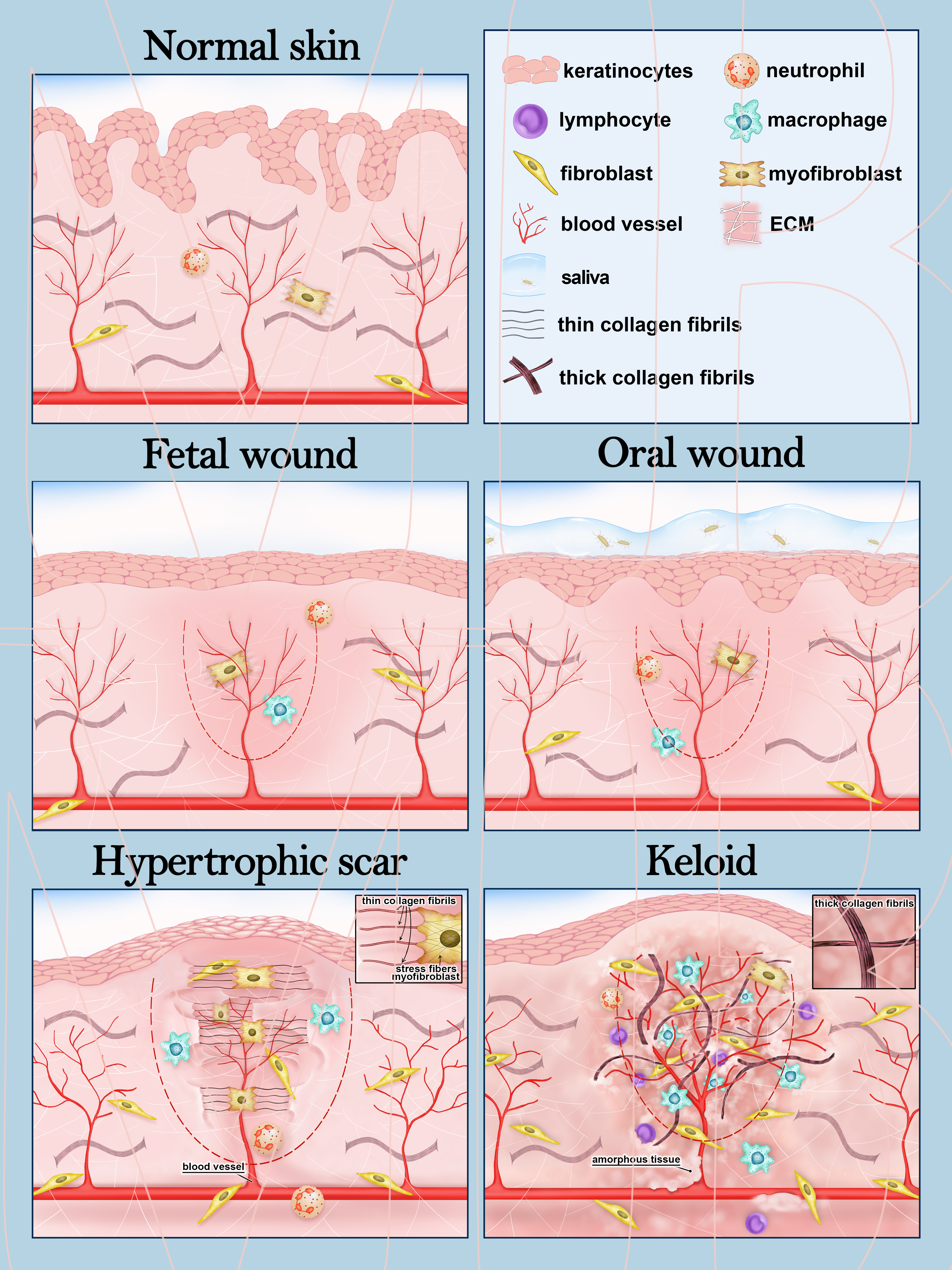 Wound healing and scarring