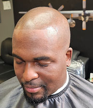 After Scalp Micropigmentation_edited.jpg