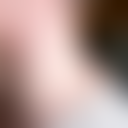 México registra casi 3 mil casos de sarampión; brote se concentra en Chihuahua