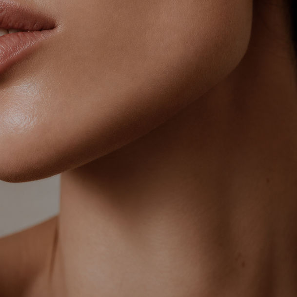 skin texture, pores, acne, Microneedling King's Cross London