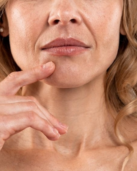 Mature skin with visible fine lines and loss of firmness around the lower face.
