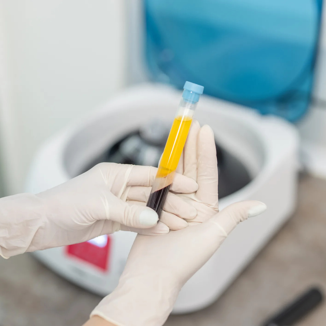 Bio filler treatment