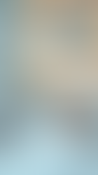 Refine Your Jawline with Chin Contouring Injections