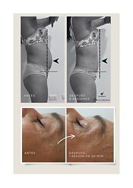 Clinica ave fisioterapia espcializada grecia suelo pelvico adulto mayor sexologia embarazo