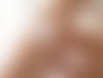 A person rubbing topical lotion on forearm.