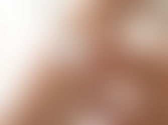 A person rubbing topical lotion on forearm.