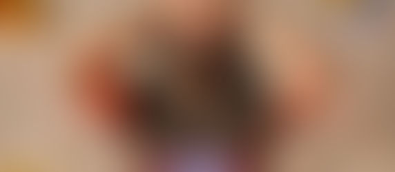 A man holding his head from brain fog