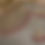 Thumbnail: Akoyas
