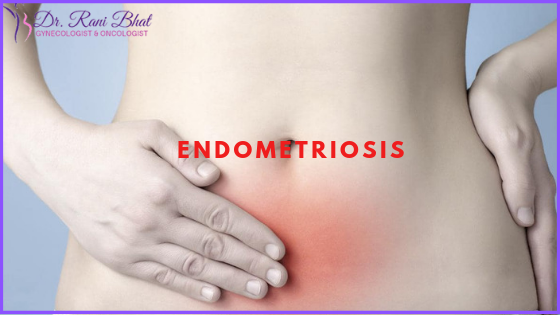 Best endometriosis treatment in bangalore