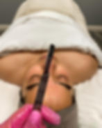 Dermaplane