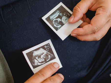 The Pregnancy Journey Continues: the Second Trimester
