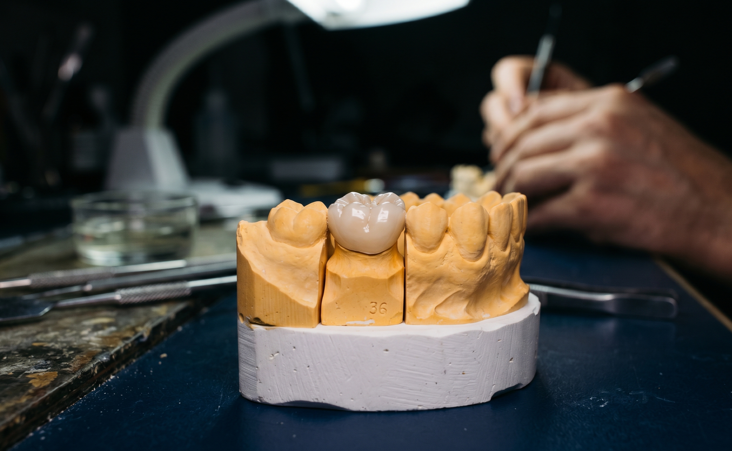 Corona dental estética