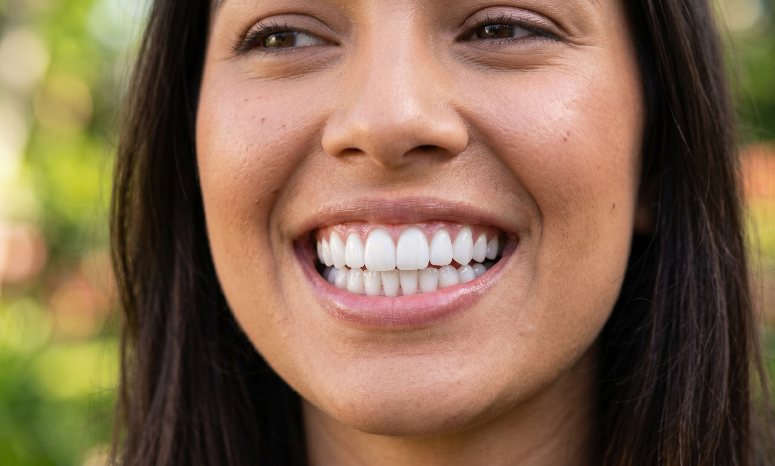 Sonrisa con carillas dentales
