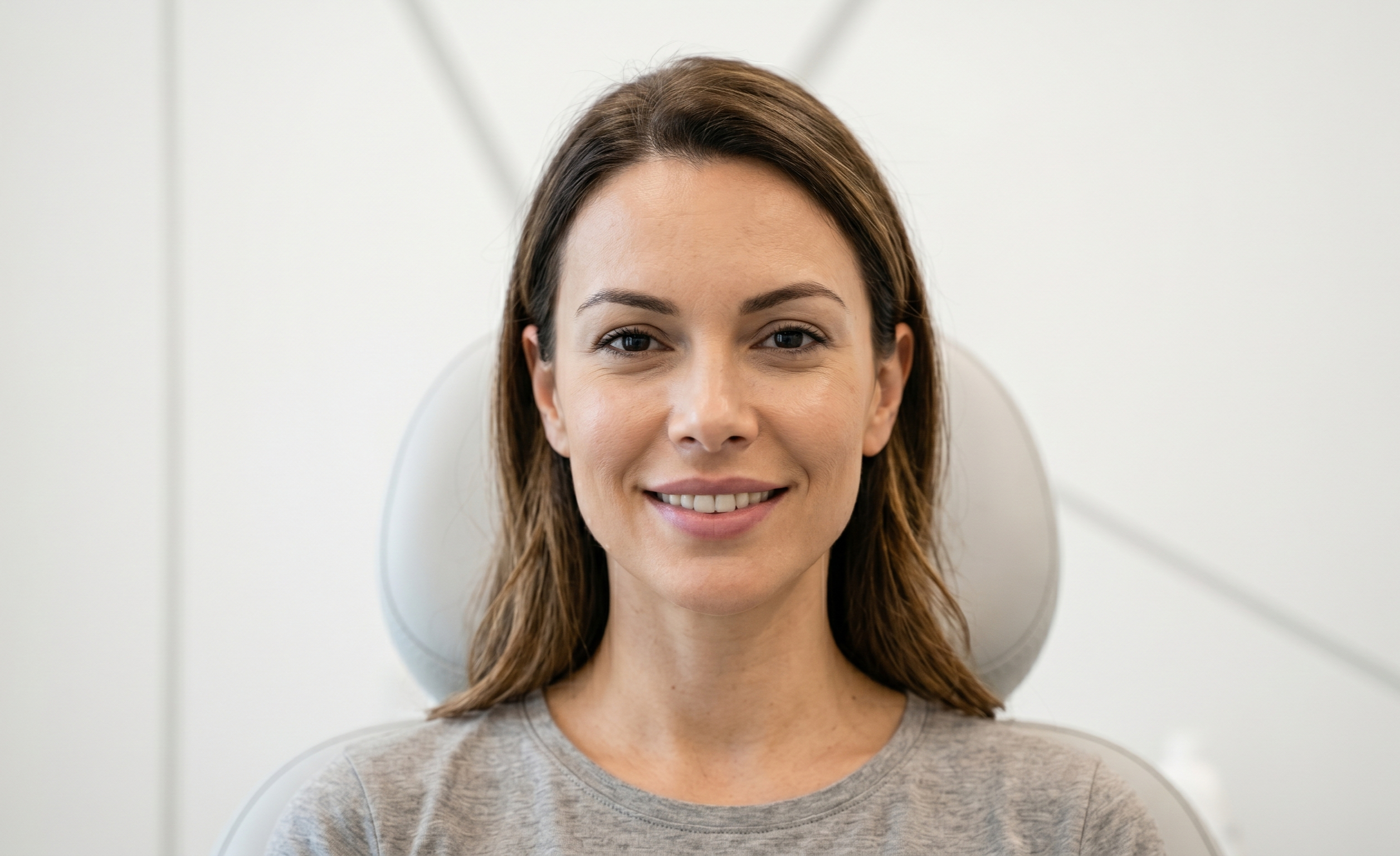 Resultado de tratamiento de bruxismo con Botox