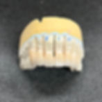 7 single crown restorations on a model.
