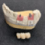 3-unit custom abutments next to the model.