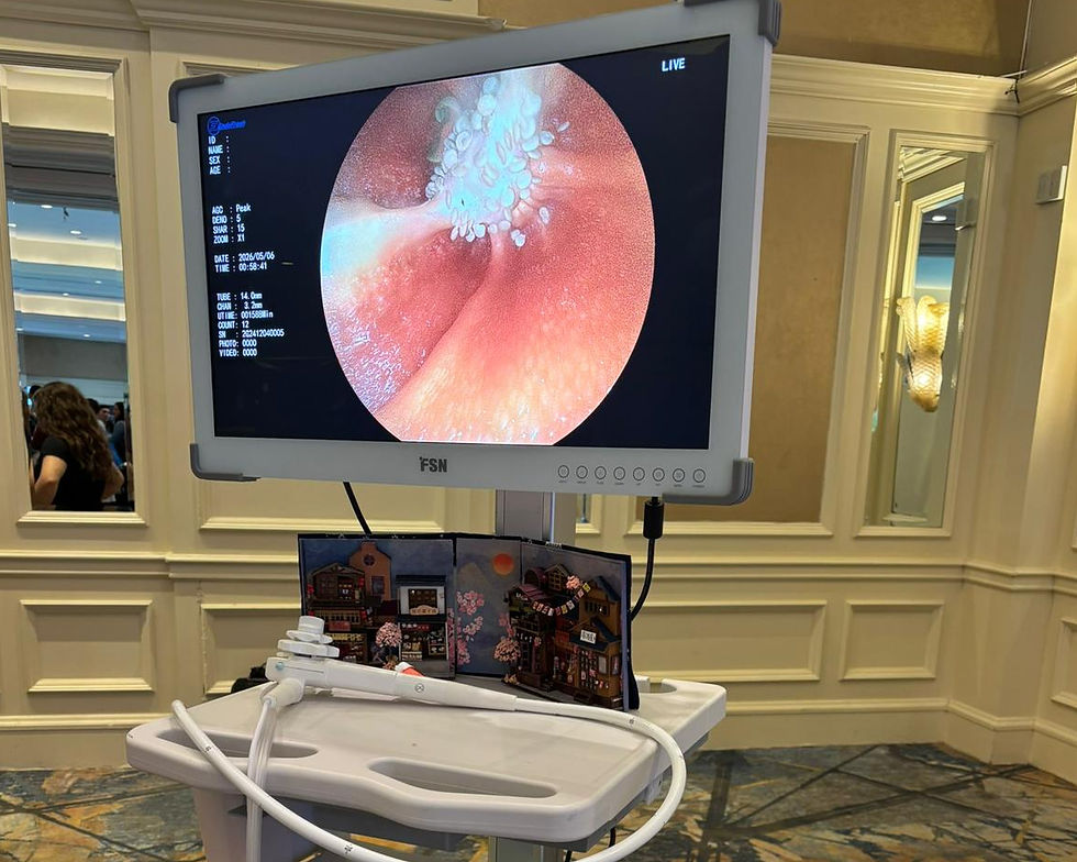 Endoscope