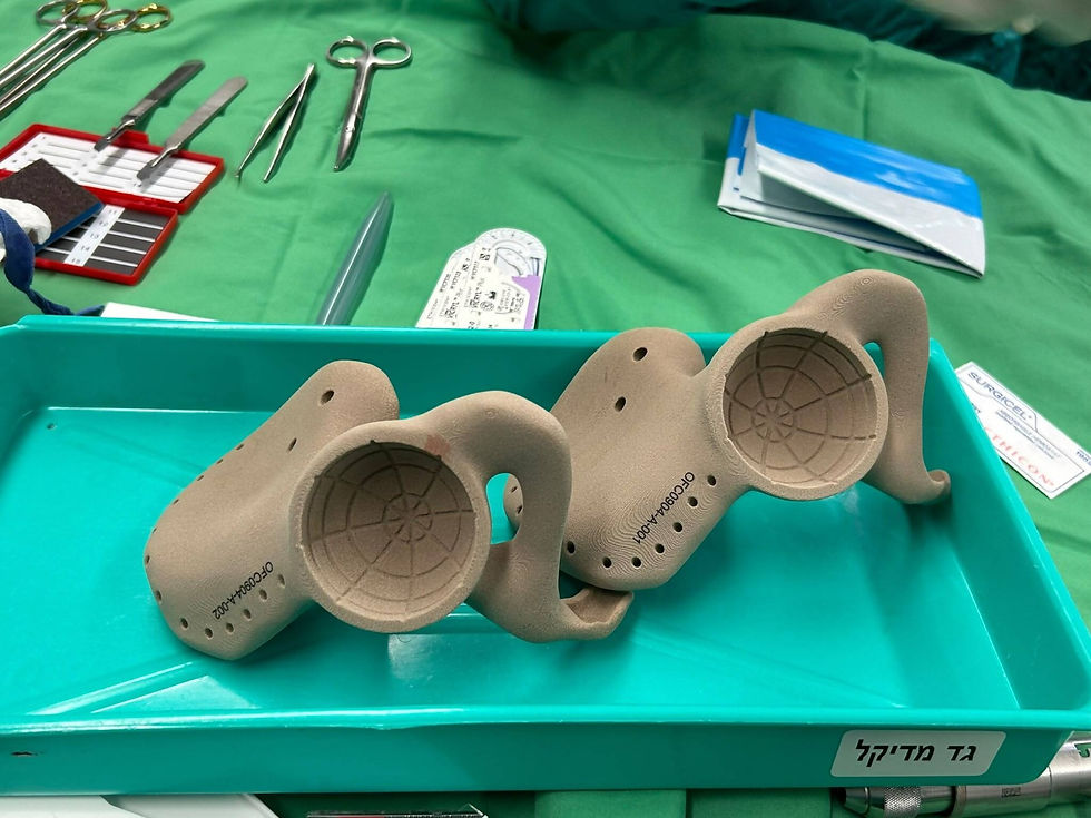 Le bassin artificiel imprimé en 3D a été implanté dans le corps de Mark