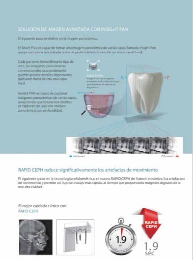Miniatura: SMART PLUS TOMOGRAFO 3D VATECH