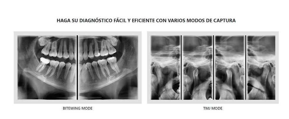 Miniatura: PAX-i Plus Pano y Ceph Rapid Scan