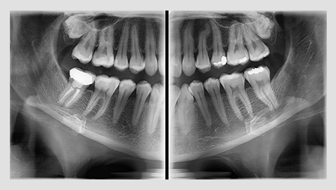 Miniatura: PAX-i VATECH PANORAMICO DENTAL 2D