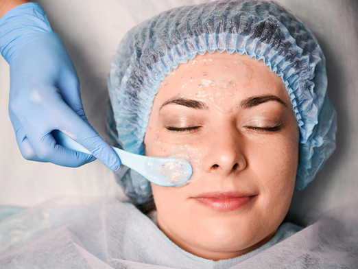 Chemical Peels: A Quick Solution for Clear, Glowing Skin