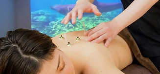 施術中イメージ