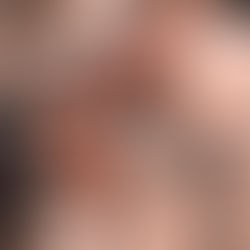 Voorkom blessures tijdens het skiën: kies de juiste brace