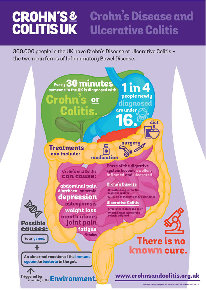 Inflammatory Bowel Disease Crohn s Ulcerative Colitis how-to-diagnose-ibs-plantforce21