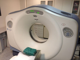 Nódulo Pulmonar