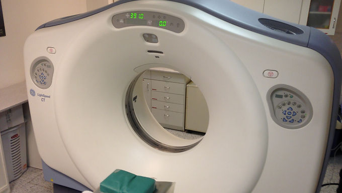 ‘AI analysis can reduce unnecessary CT scans by 30%’