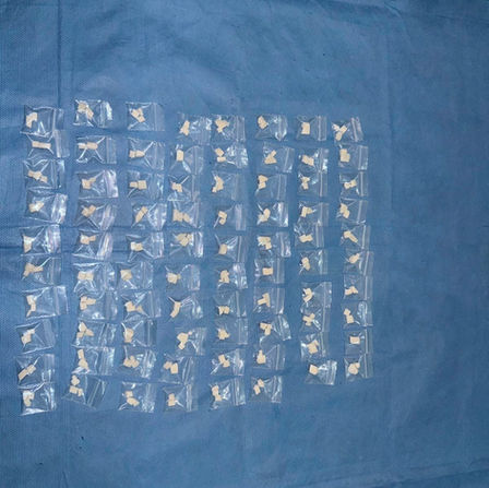 “Gran investigación" ministerial; aseguran raquítica cantidad de droga y a pareja en 5 cateos